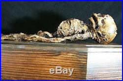 Mummified Human Fetal Skeleton In A Wooden Casket