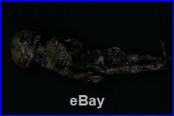 Mummified Human Fetal Skeleton In A Wooden Casket
